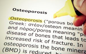 Tips for Preventing and Managing Osteoporosis
